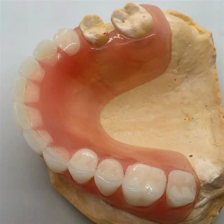 Dental Removable Partial Flexible Dentures